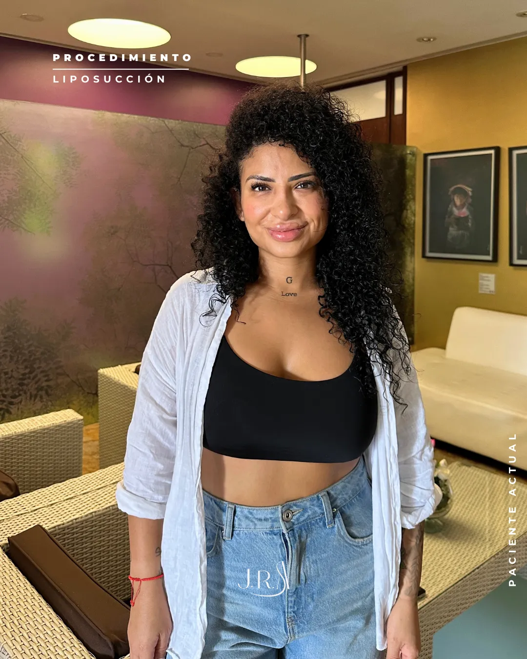 Paciente sonriente tras lipoescultura en Cali, Colombia. Resultado natural de moldeamiento corporal con el Dr. Jaime Arias.