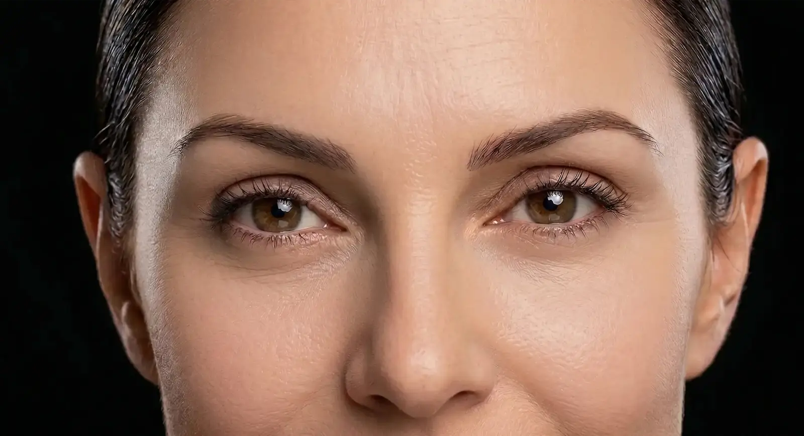 Blefaroplastia y Mirada Joven: Dr. Jaime Arias Blefaroplastia en Cali por Dr. Jaime Arias logrando una mirada descansada y juvenil sin exceso de piel.